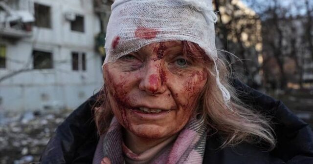 Rusiya-Ukrayna müharibəsinin simvolu: “Putinə təslim olmaqdansa, ölmək yaxşıdır” – Dünya ondan danışır-VİDEO