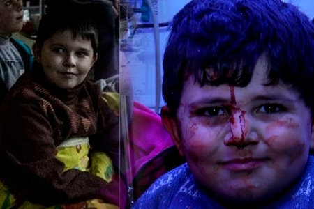 Günün fotosu: Bombardmandan sağ çıxan xarkovlu və gəncəli oxşarlar…