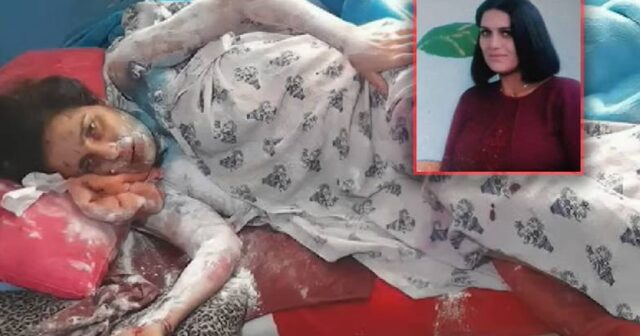 Azərbaycanda gəlinini kimyəvi maddə ilə yandıran qayınata: “Yaxşı eləmişəm” – VİDEO
