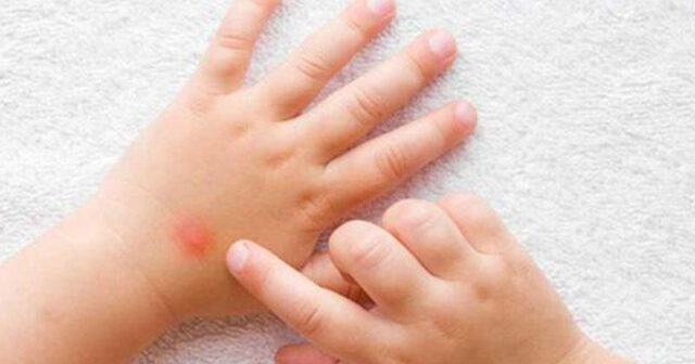 Dünyada yeni virus yayılır – “Pomidor qripi”
