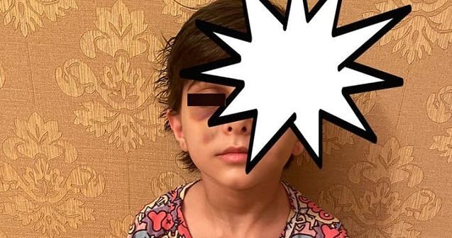 Sumqayıtda üç azyaşlı anasının sevgilisi tərəfindən döyüldü