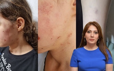 MƏKTƏBLİNİ DÖYƏN RƏSİLƏ ƏLİYEVANI HANSI CƏZA GÖZLƏYİR? – VƏKİLDƏN AÇIQLAMA