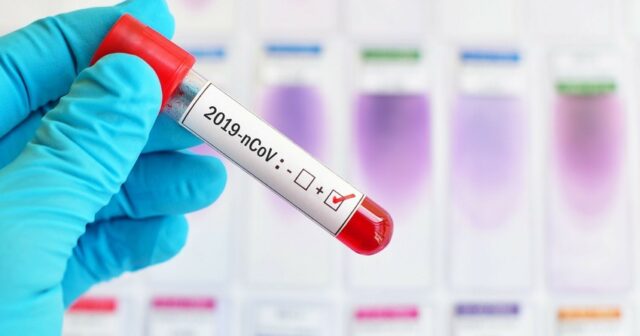 Azərbaycanda koronavirusa yoluxanların sayı azaldı