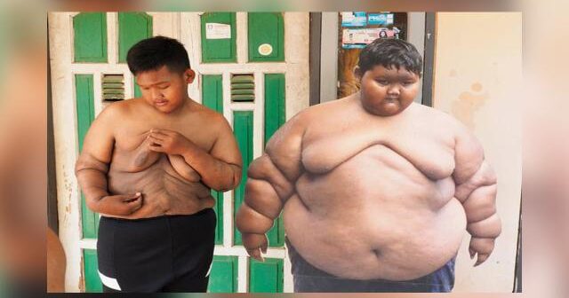 DÜNYANIN ƏN KÖK UŞAĞI 114 KG ARIQLADI – FOTO