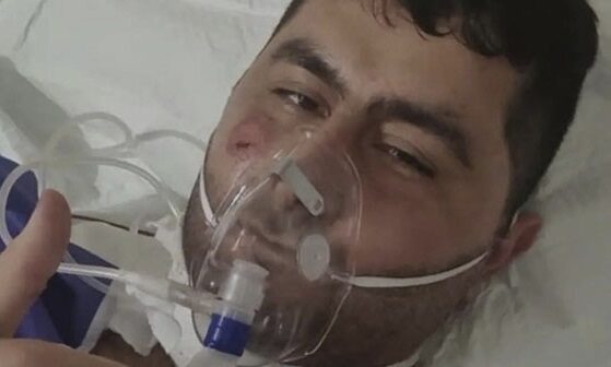 Terrorçunu zərərsizləşdirən Vasifin əməliyyatdan sonrakı – Fotosu