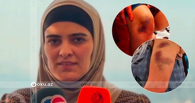 “Silahı başıma dirədi” – Polkovnik-leytenantın arvadı – Video