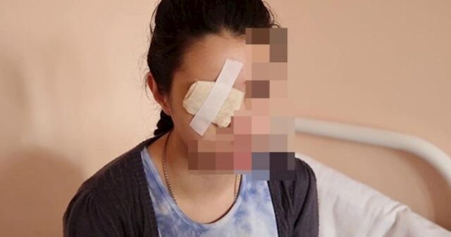 Evə taksi ilə gəldiyi üçün döyülən qadın: “Uşaqlar gözümü necə çıxardığını gördülər”