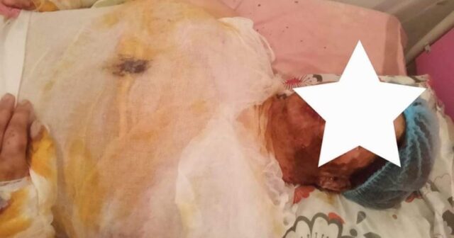 NÖVBƏTİ ERKƏN NİKAH QURBANI… UŞAQ SIĞINACAQDA, ANA XƏSTƏXANADA – FOTO