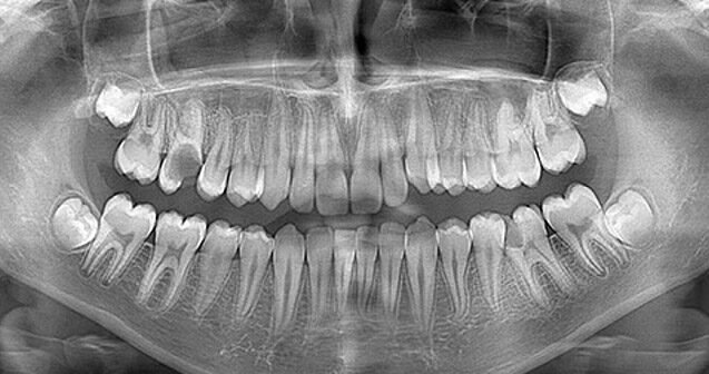 Stomatoloji klinikada rentgen-müayinə fəaliyyəti dayandırıldı