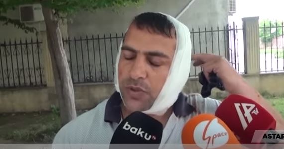 Qulağını eşşək qopardan kişi görün kimdir — VİDEO