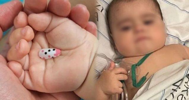İsmayıllıda körpənin nəfəs borusuna taxma dırnaq düşüb