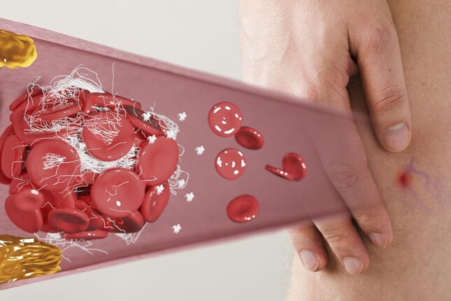 10-12 saat oturmaq insanı öldürə bilər – Uzman həkim