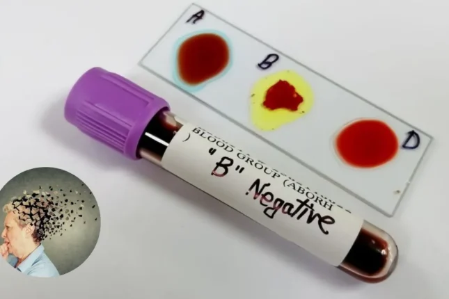 Alzheimer riskini artıran qan qrupu məlum oldu