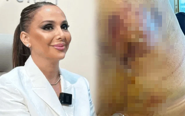 “Həkim məni 3 dəfə əməliyyat edib pis vəziyyətə qoydu” – Foto