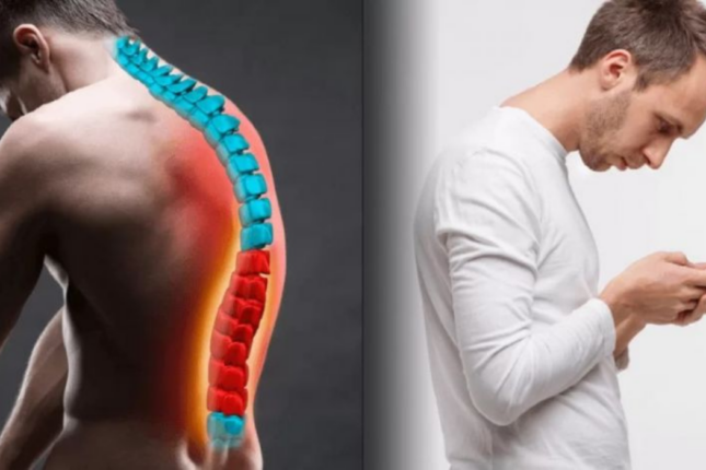 Kifozun qarşısını almağın yolları: Sağlam onurğa üçün vacib vərdişlər