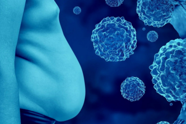 Piylənmə ilə bağlı xərçəng ölümləri kəskin artıb ARAŞDIRMA