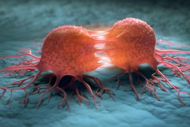 Azərbaycanda xərçəngin qorxulu statistikası