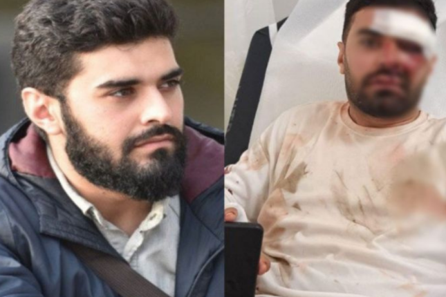 Rəvan Cavid Türkiyədə motosikletlə qəza törədərək ağır xəsarət alıb