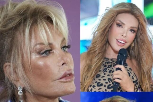 79 yaşlı Ajda Pekkandan üzgərmə əməliyyatından sonra ŞOK – Fotolar