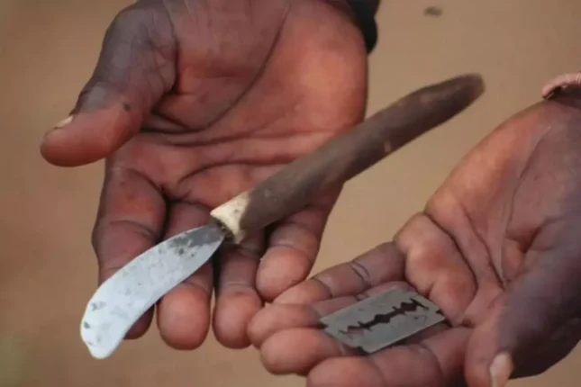 Kütləvi sünnət mərasimində faciə: 39 uşaq ölüb, 11 uşaq isə…