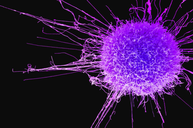 Alman alimlər xərçəngin dərmanını tapdı