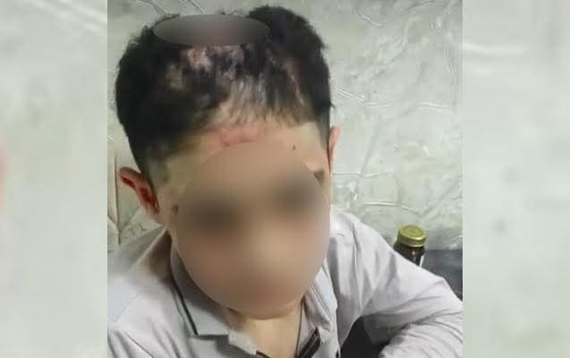 Sabunçuda uşağa işgəncə verən qəyyum saxlanılıb, cinayət işi açıldı