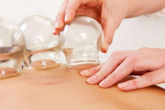 Bakıda belinə banka qoyulan qadın yanaraq öldü