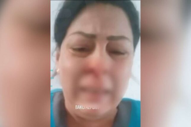 Xəstəxana direktoru işçini döyüb? – Video