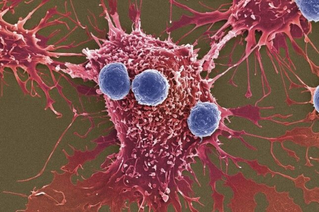 Hər 10 evdən 7-də var – Xərçəng yaradır