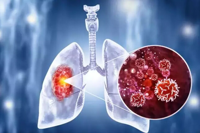 Dünyanın ən ölümcül yoluxucu xəstəliyi: Hər il bir milyon insan öldürür