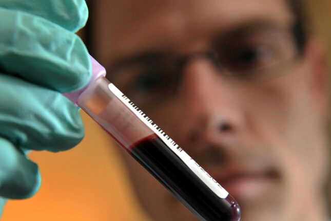 Azərbaycan idmançısı 2 illik diskvalifikasiya olundu Azərbaycan idmançısı 2 illik diskvalifikasiya olundu