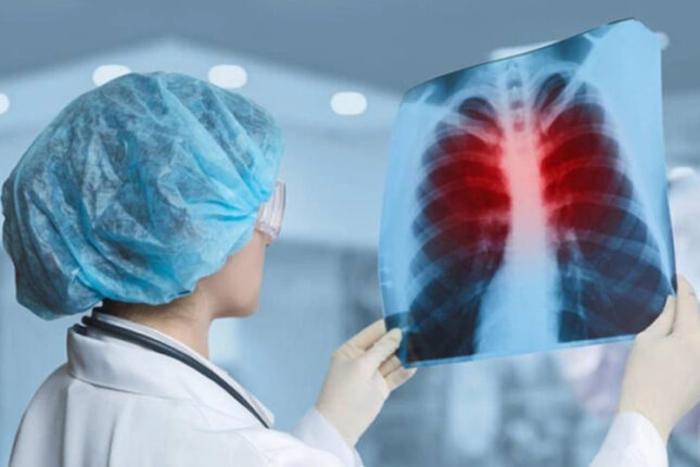 Bu qida ağciyəri təmizləyir