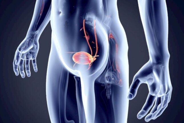 Çox adam böyrək daşı ilə səhv salır, xərçəngin gizli əlamətidir