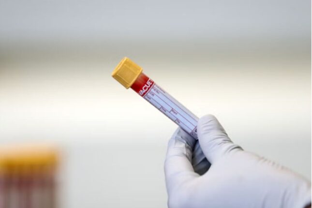 İşə qəbulda narkoloji rəy təqdim etməli olacağıq