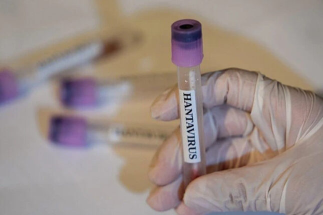 Hantavirus o ölkəyə də çatdı