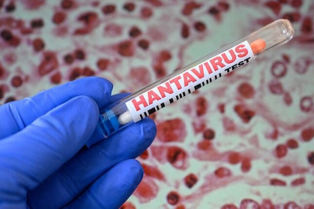ÜST-dən hantavirusla bağlı MÜHÜM AÇIQLAMA