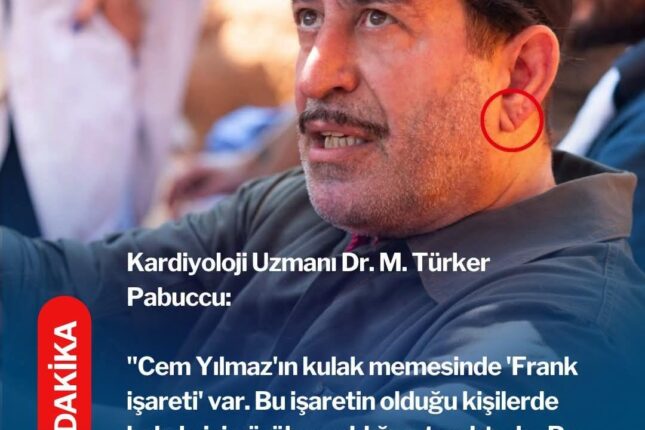 Qulağınızda bu xətt varsa, diqqətli olun – Foto Qulağınızda bu xətt varsa, diqqətli olun – Foto