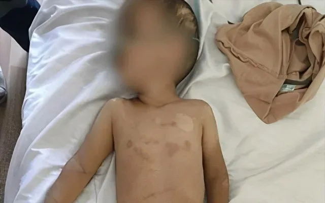 Lənkəranda 3 yaşlı uşağa zorakılıq edən ögey ata saxlanıldı Lənkəranda 3 yaşlı uşağa zorakılıq edən ögey ata saxlanıldı