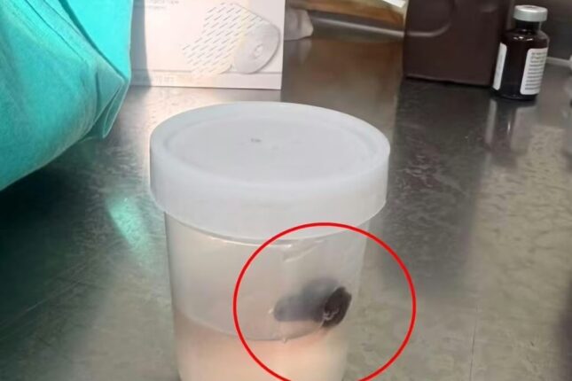 10 yaşlı uşağın boğazından canlı zəli çıxarıldı – Foto 10 yaşlı uşağın boğazından canlı zəli çıxarıldı – Foto