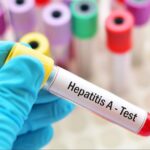 Hepatit B-nin müalicəsində yeni KƏŞF hepatit-b-nin-mualicesinde-yeni-kesf
