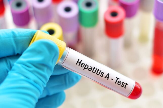 Hepatit B-nin müalicəsində yeni KƏŞF Hepatit B-nin müalicəsində yeni KƏŞF